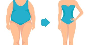 Woman before and after weight loss, illustration.